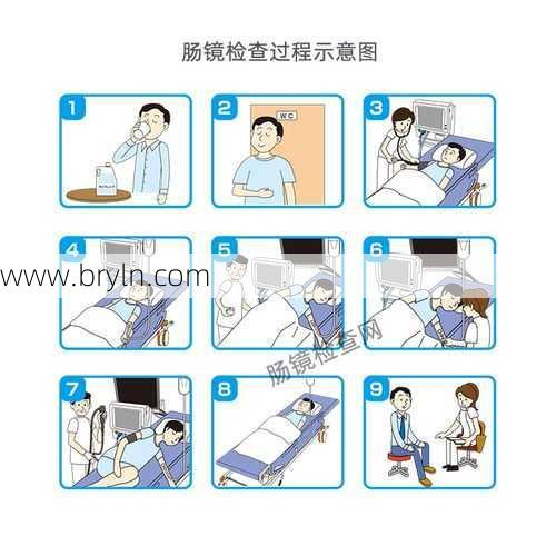 肠镜是怎么做的(肠镜检查是怎么进行的?什么情况下需要做肠镜检查你知道吗?)