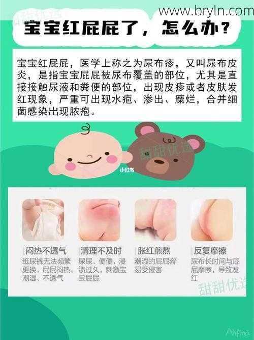 宝宝红屁股怎么办,看这一篇文章就够了