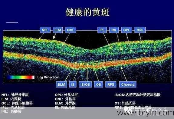 三种常见眼底病、黄斑病变,oct检查图示说明