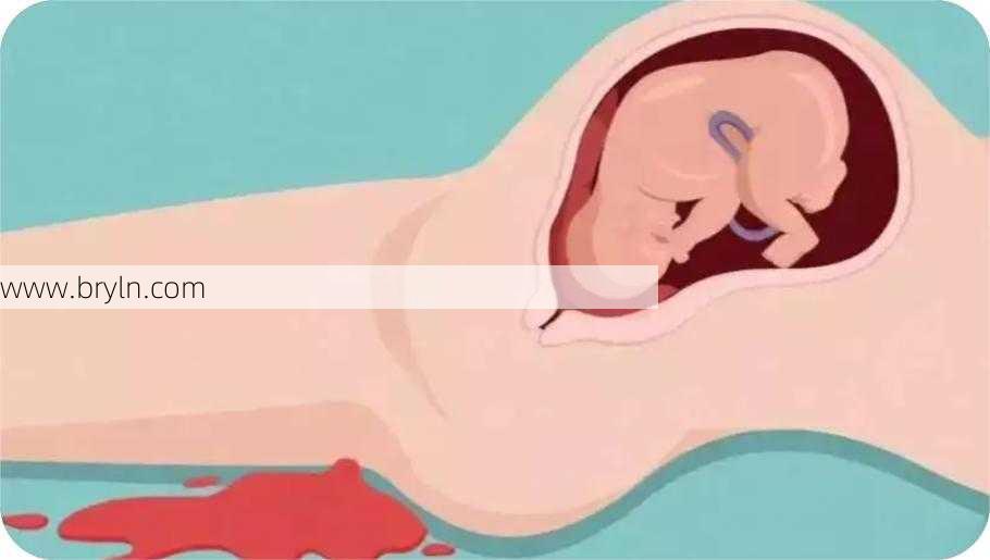 刮宫疼吗(女人刮宫,有人疼到“全身冒汗”有人“没有感觉”)