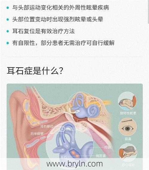 耳石症挂什么科(有一种眩晕叫耳石症,打针吃药无效,教你4招或可治好)