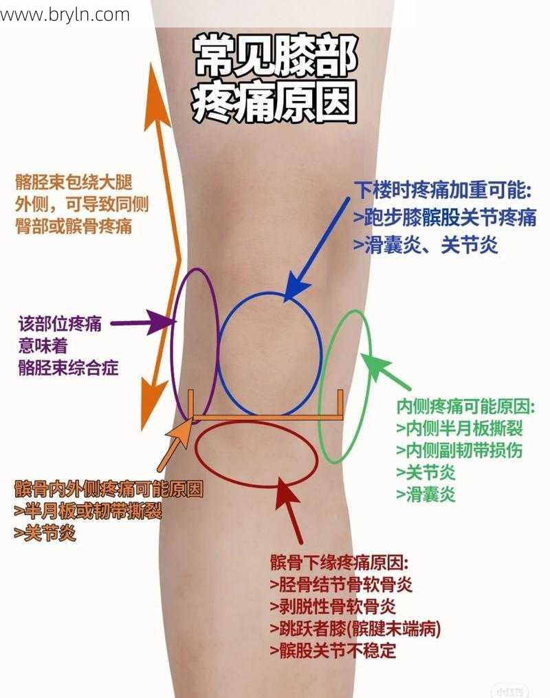 腿疼是怎么回事()