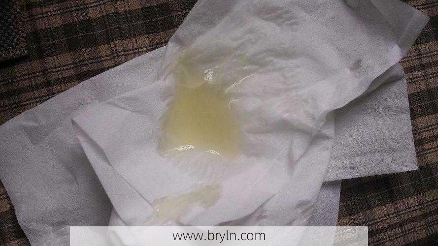 精液发黄正常吗？正常的精液是什么样？