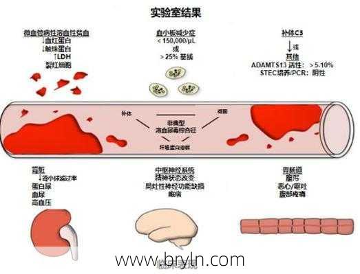 什么是溶血症？有什么症状，能治疗吗？