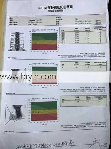 什么是骨密度检查？该怎么查？关于骨密度检查，你想知道的都在这