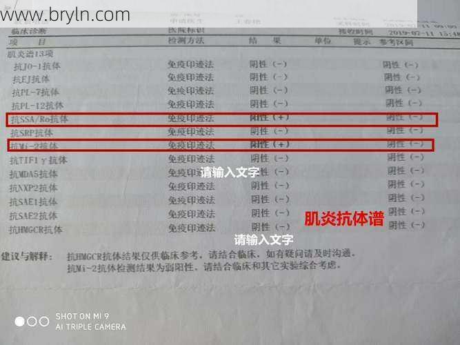 间质性肺炎患者筛查肌炎抗体谱很重要