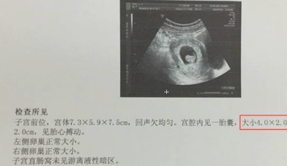 b超能检查出什么()