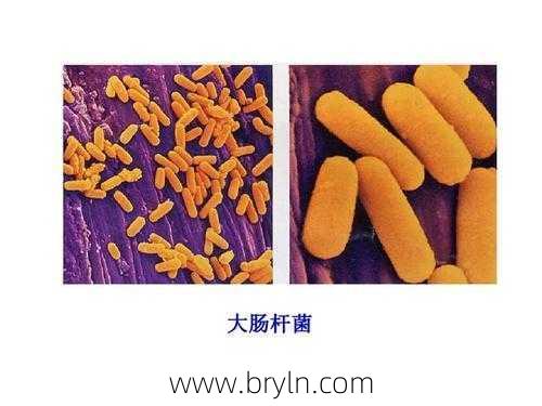 大肠杆菌是什么()