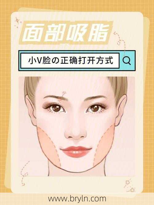 面部吸脂多少钱(揭秘面部吸脂术)