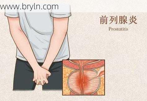 前列腺挂什么科(勃起功能障碍、前列腺炎…男人得了这些病，该看医院哪个科？)