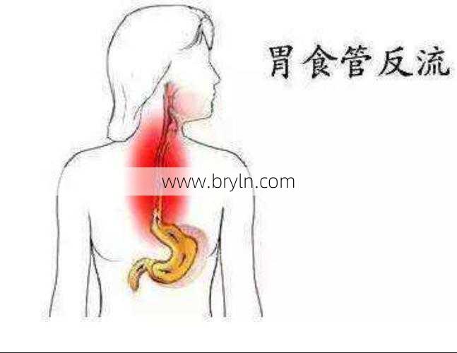 食道炎会自愈吗()