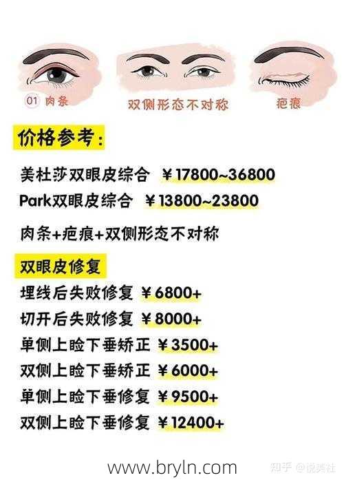埋线双眼皮价格(做埋线双眼皮多少钱啊)