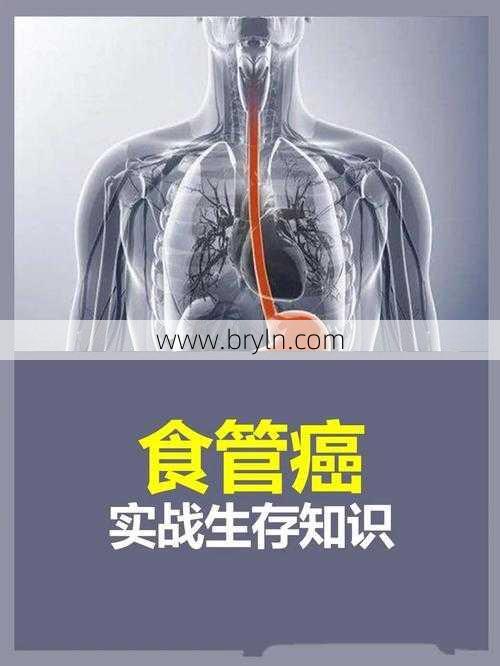 食道癌能治好吗()