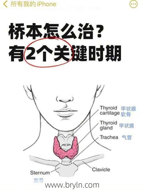 甲状腺炎能自愈吗()