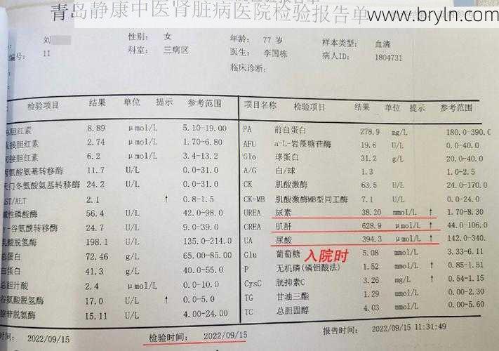 血肌酐正常值(人体肌酐正常值是多少,在这一范围内,还属于正常)