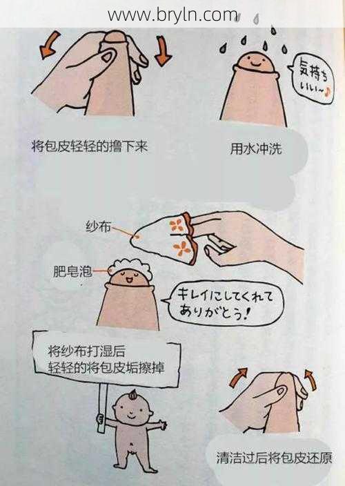 割包皮挂什么科(包皮手术高峰来临,准备带小孩来手术的家长,这三个问题要注意)
