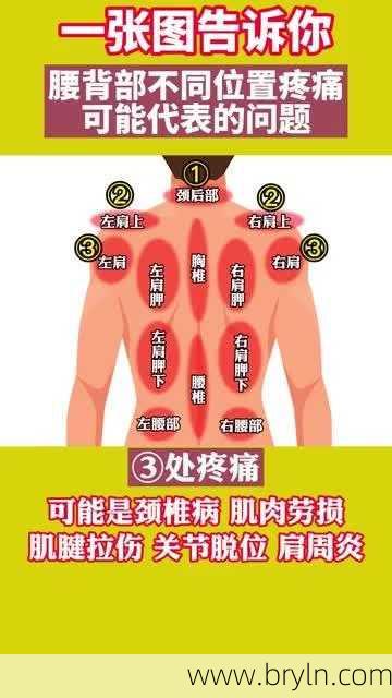 背心痛(后背疼与多种病有关!一张图看得明明白白)