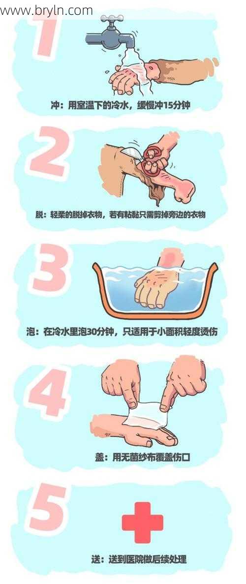 被开水烫了,最有效的方法是什么?