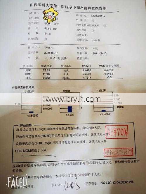 做唐筛需要空腹吗()