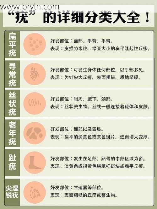 长疣是什么原因()