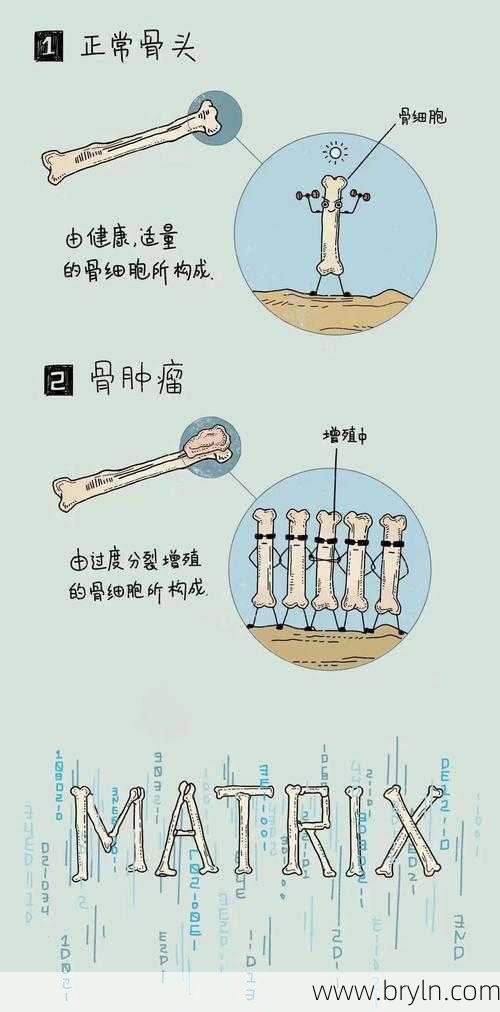 为什么会得骨癌(骨友之家|得了骨癌必须「截肢」吗?引起骨癌的原因有哪些?)
