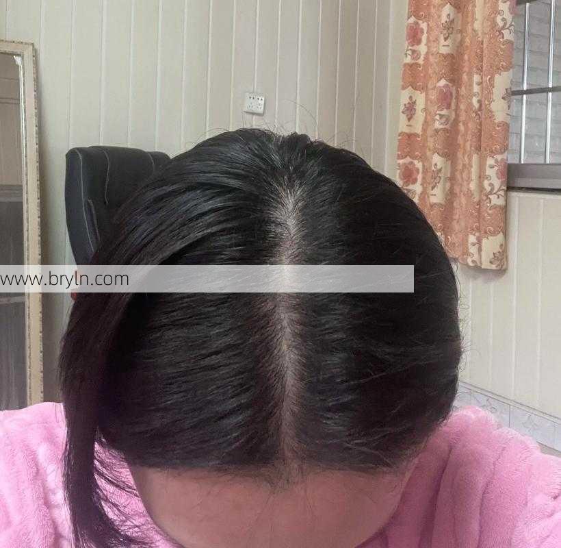 洗头掉头发(洗头总掉头发,是要秃了吗?告诉你一个脱发的真相……)