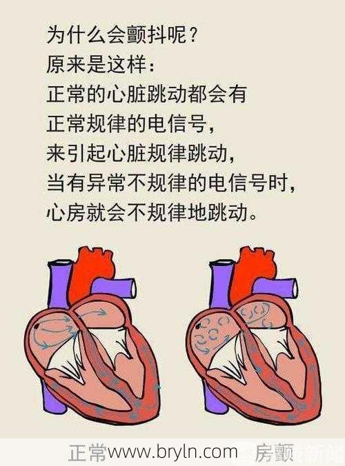 阵发性房颤与持续性房颤,都有可能诱发脑梗塞,都需提防