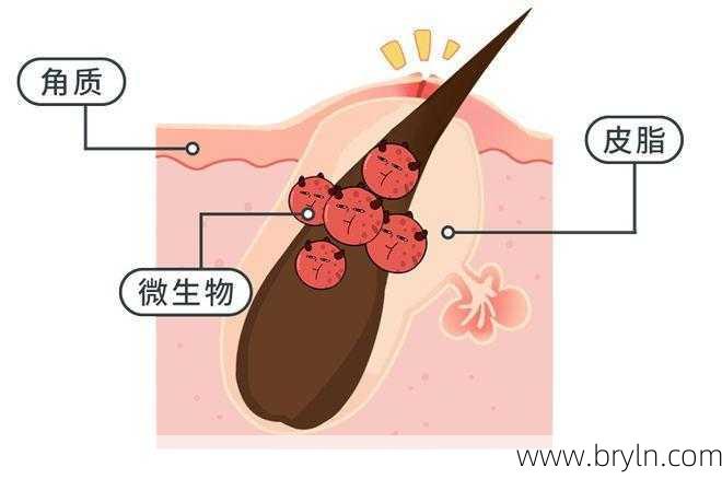 女生下面长痘痘是不是严重的病?并非都这样,还有这几点原因
