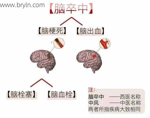 脑血流(什么是脑出血?病因病理和临床特点有哪些?如何治疗和预防?)