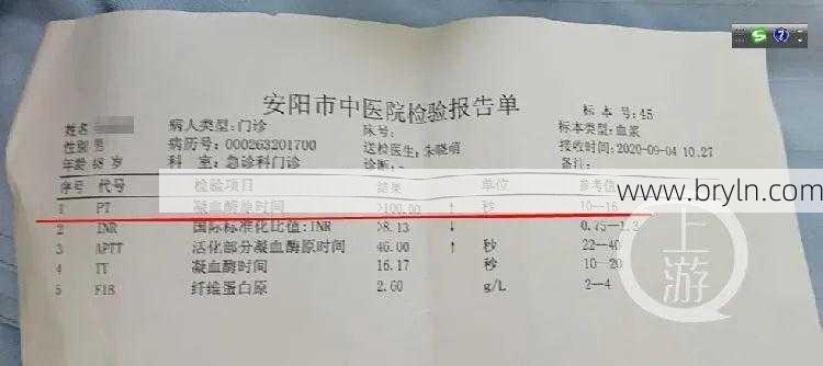 凝血酶时间()