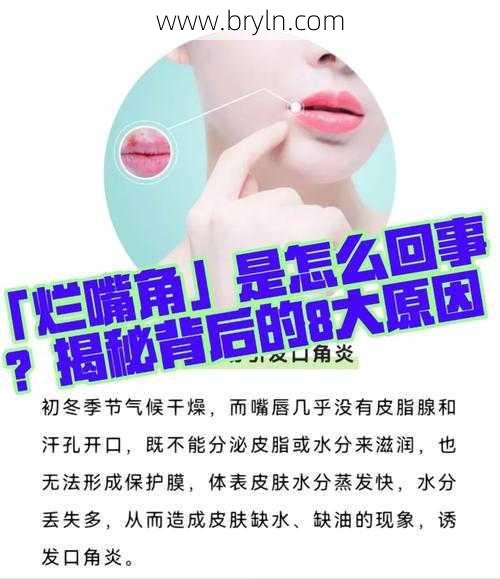 嘴角烂是什么原因(烂嘴角是怎么回事？这种维生素能有效治愈它)