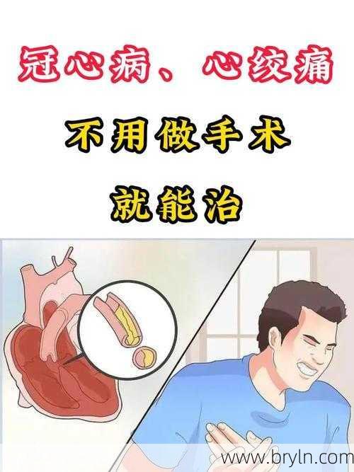 心绞痛能治好吗()
