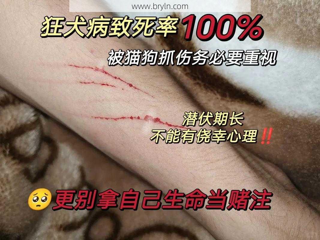 狂犬病能治吗(狂犬病没得救？及时采取这种处理方式，或能免于受难)