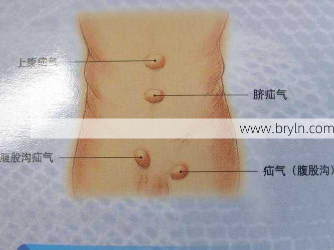 小肠气是什么症状()