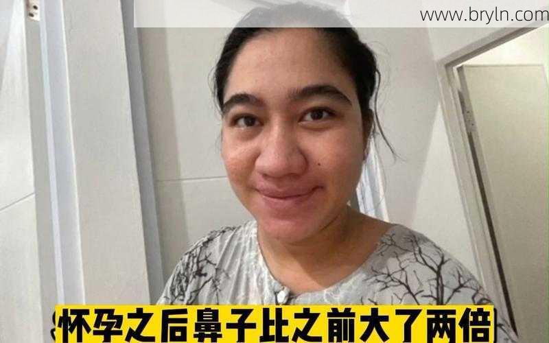鼻子变大()