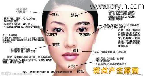 眼角长斑是什么原因引起的？中医说：太阳穴长斑的人易抑郁！