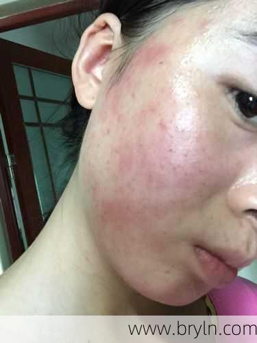 大三阳症状()