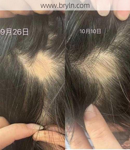 60天白发转黑，如此“神药” 你信吗？