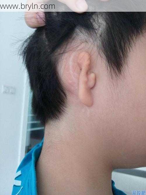 耳朵畸形()