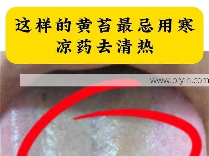 这种黄苔，清热是大忌，因为它是“真寒假热”本质还是寒湿...