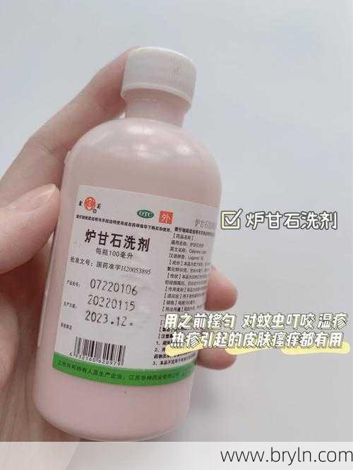 炉甘石洗剂副作用()