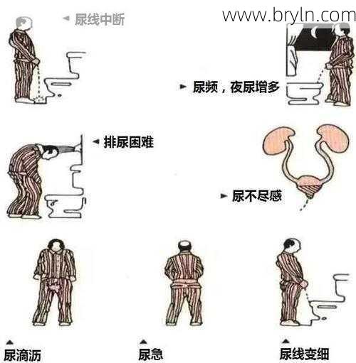 尿急尿频尿不尽(尿频尿急尿不尽，原因揭秘！)