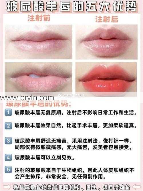 玻尿酸丰唇多少钱(玻尿酸丰唇的效果如何)