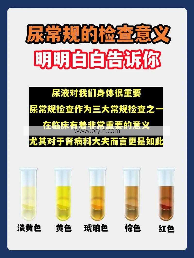 验尿能检查出什么(尿常规究竟是检查什么病？医生：对这3种病有着明确的判断)