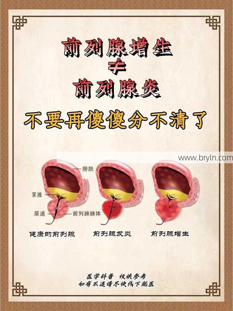 什么是前列腺增生()