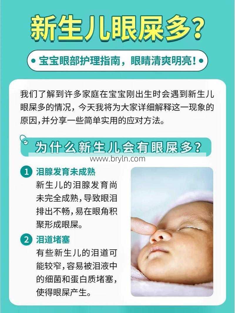 宝宝眼屎多，不是上火了，而是这3点！不要迷信偏方去治疗