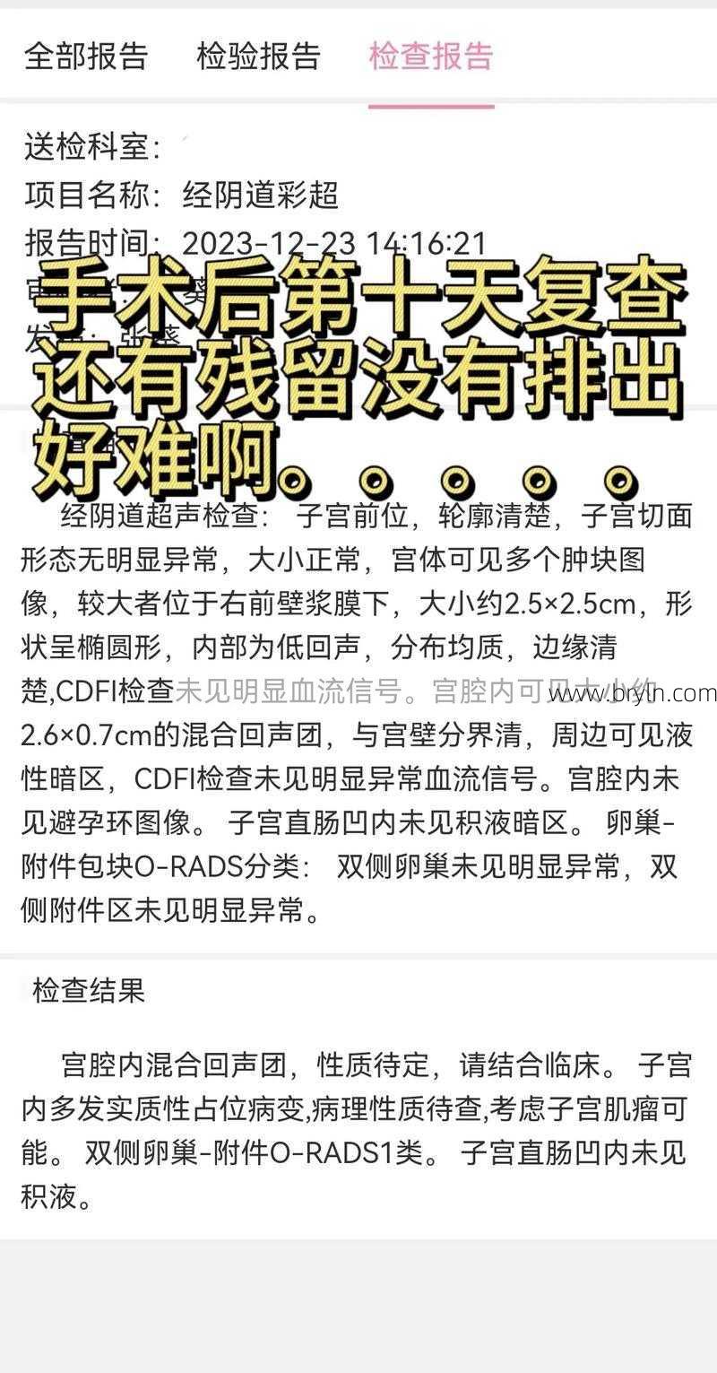 刮宫需要休息几天()
