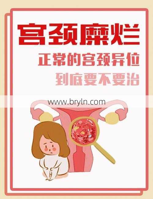 宫颈糜烂会自愈吗(宫颈糜烂能治好吗？)