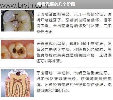 磨牙缺什么()