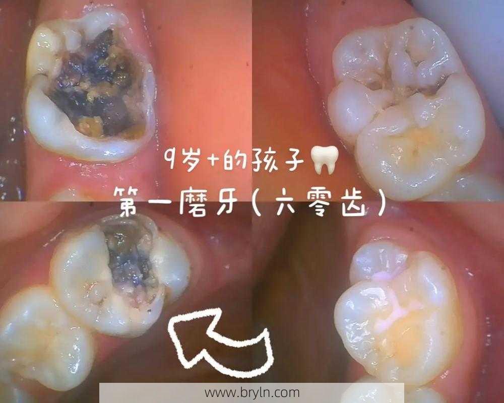 磨牙是缺什么()